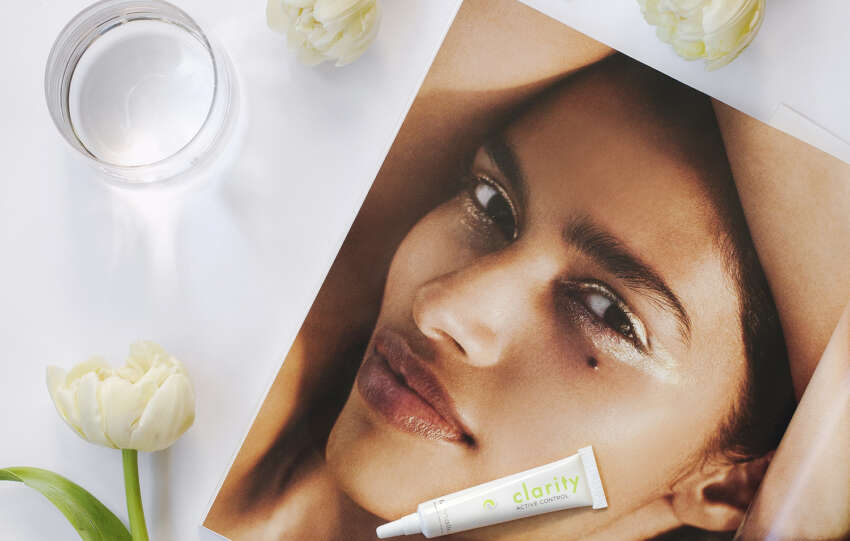 Managing hyperpigmentation: The do's and don'ts