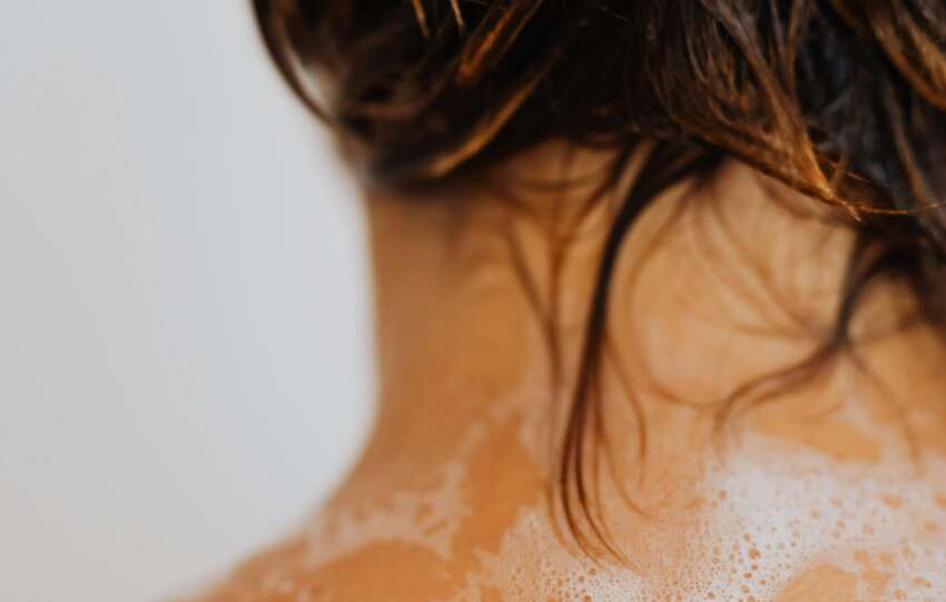 Don't let body acne get you down this summer: Here's what you can do to minimise breakouts