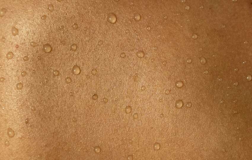 The skin barrier reset: Your winter routine needs