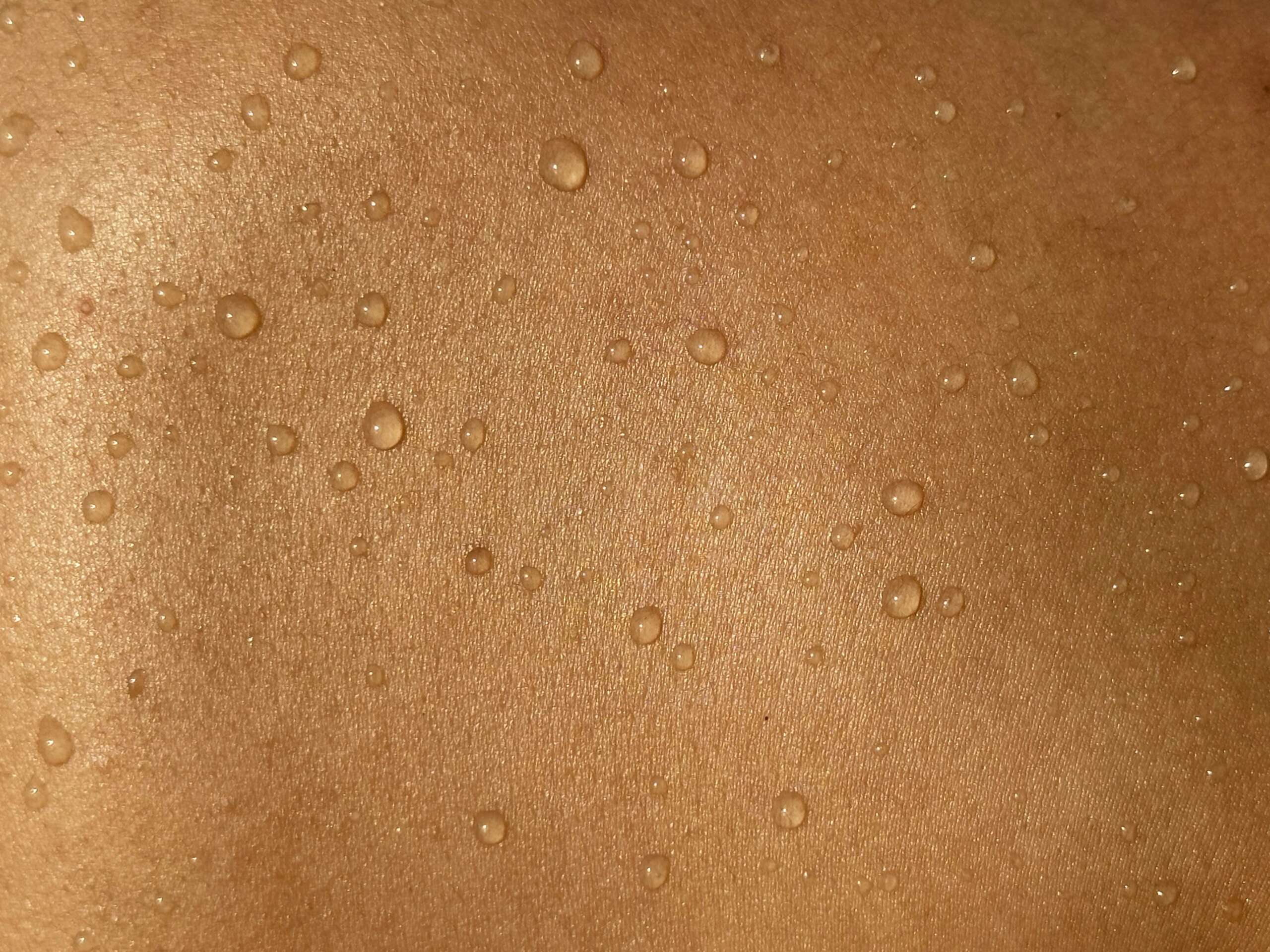 The skin barrier reset: Your winter routine needs
