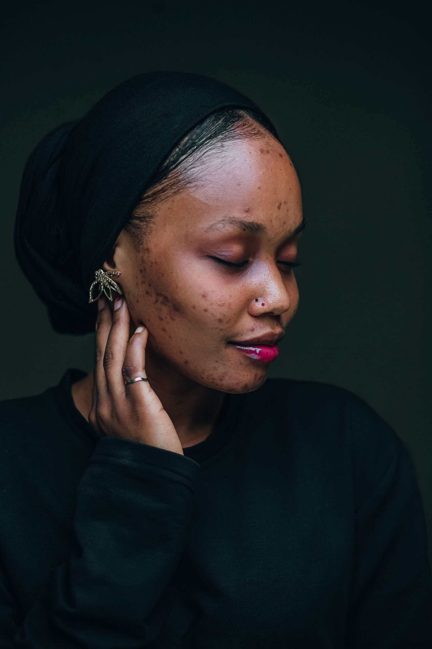 Why your skin starts building dark marks before summer even begins