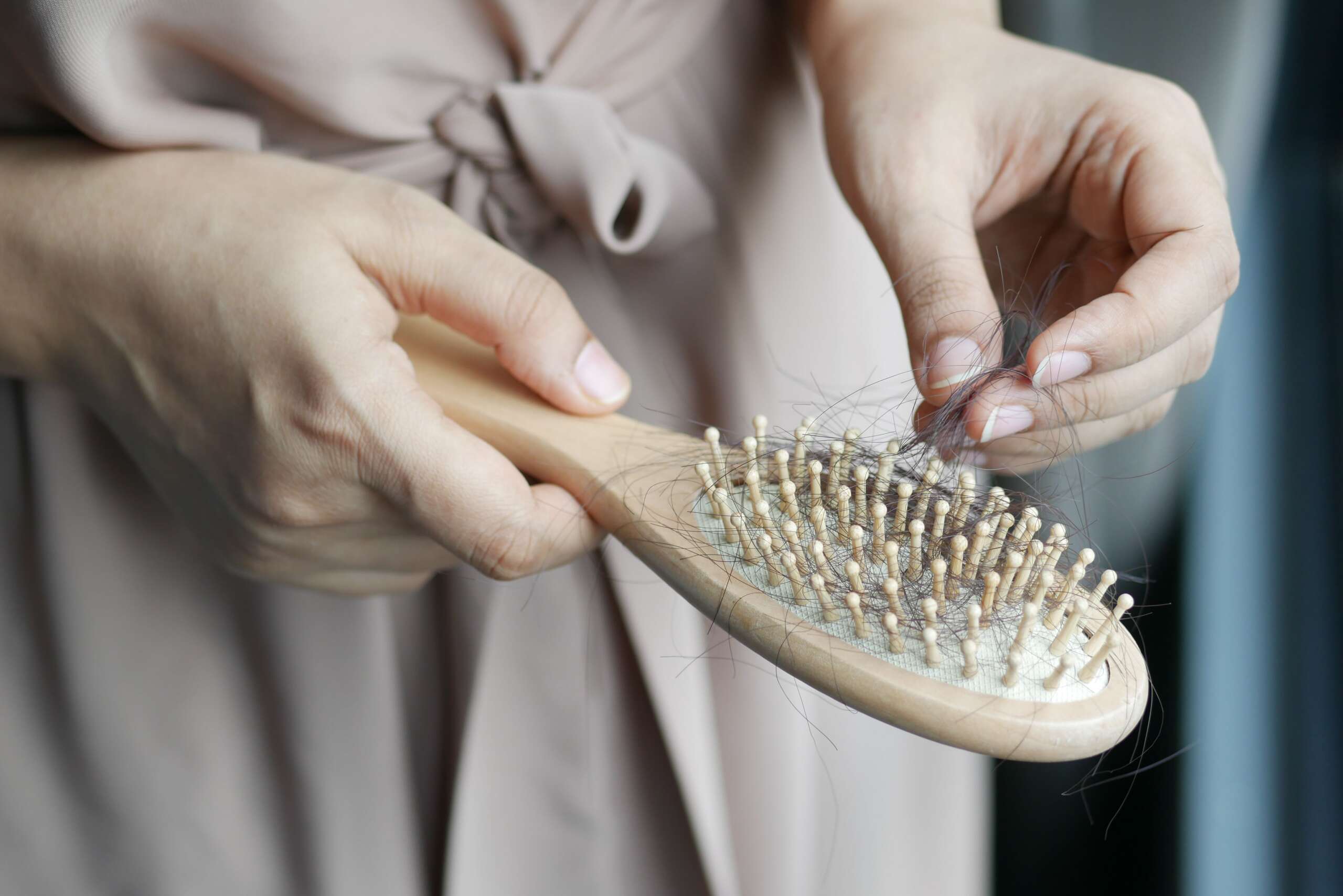 Alopecia Awareness Month: Breaking the stigma around hair loss